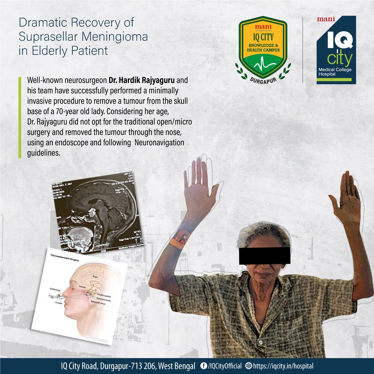 Dramatic Recovery of Suprasellar Meningioma in Elderly Patient, Neuroscience Department