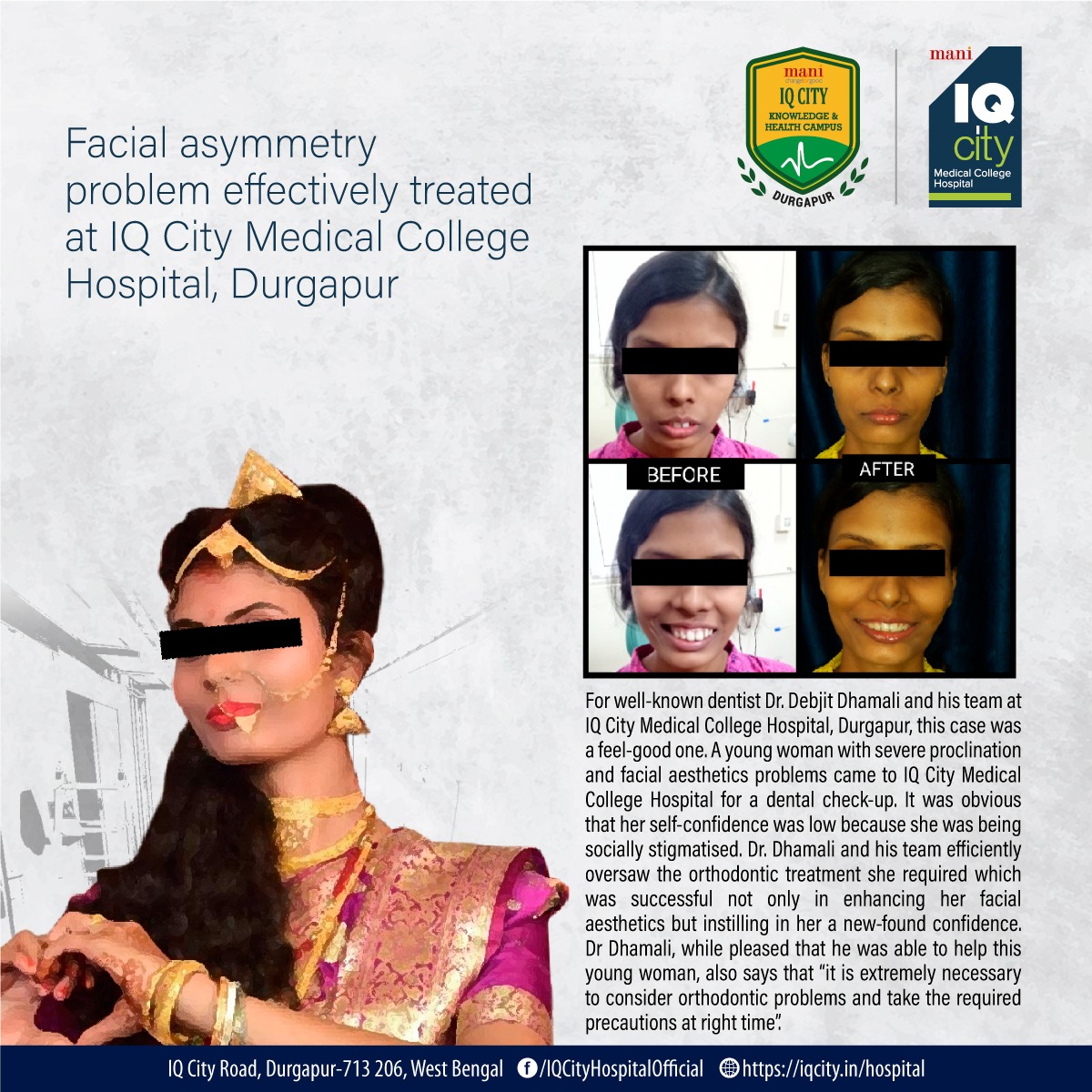 Facial asymmetry problem effectively treated at IQ City Medical College Hospital, Durgapur